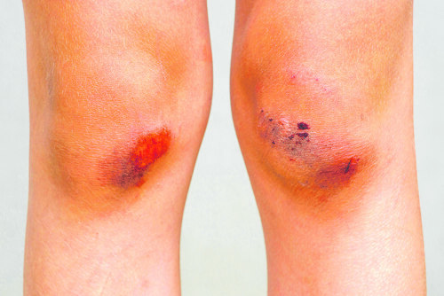 Bildunterschrift (Bildrechte sind zwingend anzugeben!)